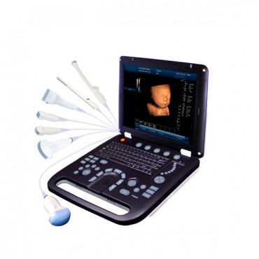 color doppler sonography