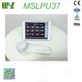 4D Wireless Probe Bladder Ultrasound Scanner MSLPU37 price