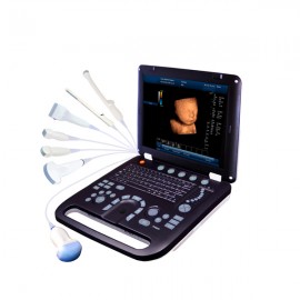 color doppler sonography