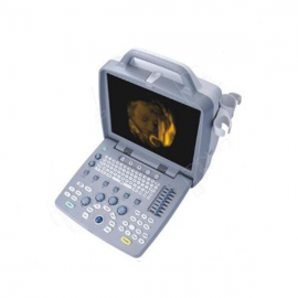 Show You The Touch Digital Mobile Color Doppler Ultrasound MSLCU32