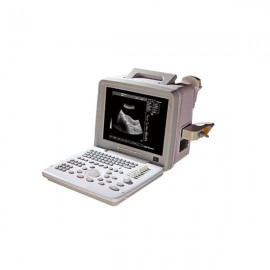 Full Digital Input Screen Ultrasound Machine MSLPU01