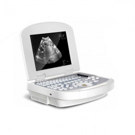 Comprehensive Use Portable & Laptop Ultrasound Machine MSLPU28