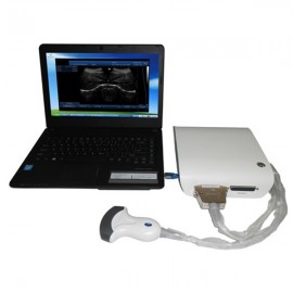 Enhanced 3D Portable Ultrasound Equipment MSLPU15
