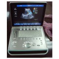 Preferential Season !! 2015 Popular Laptop 2d Color Doppler Ultrasound Machine-MSLCU12