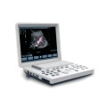 Best Selling Portable Color Ultrasound Machine MSLCU26