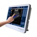 Well Worth 2016 Touch Screen Laptop Ultrasound Machine-MSLCU29 For Sale