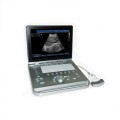 Comprehensive Digital Ultrasound Diagnostic Imaging Machine MSLPU25