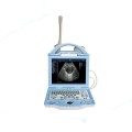 High Cost-Effective LED Human Ultrasound Scanner MSLPU27