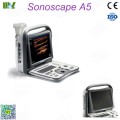 ultrasonido portatil sonoscape a5 price list : ultrasonido abdominal