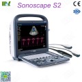 Factory direct sales ecografo sonoscape s2 price list