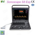 Factory direct sales best sonoscape ultrasound machine S8EXP