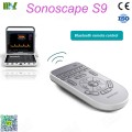 ecografie transfontanelara SonoScape S9 | ecografie doppler