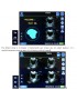 4D Wireless Probe Bladder Ultrasound Scanner MSLPU37 for sale