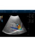 doppler ultrasound cost