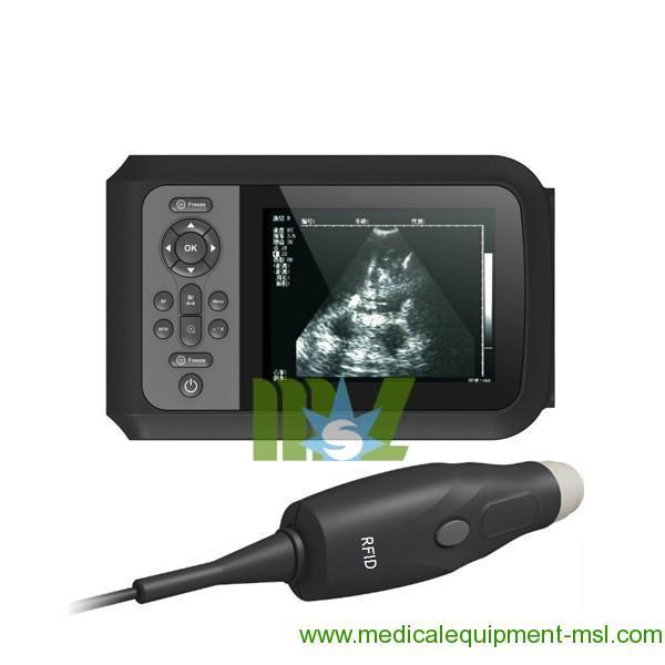 mini ultrasound, small ultrasound machine, mini ultrasound machine