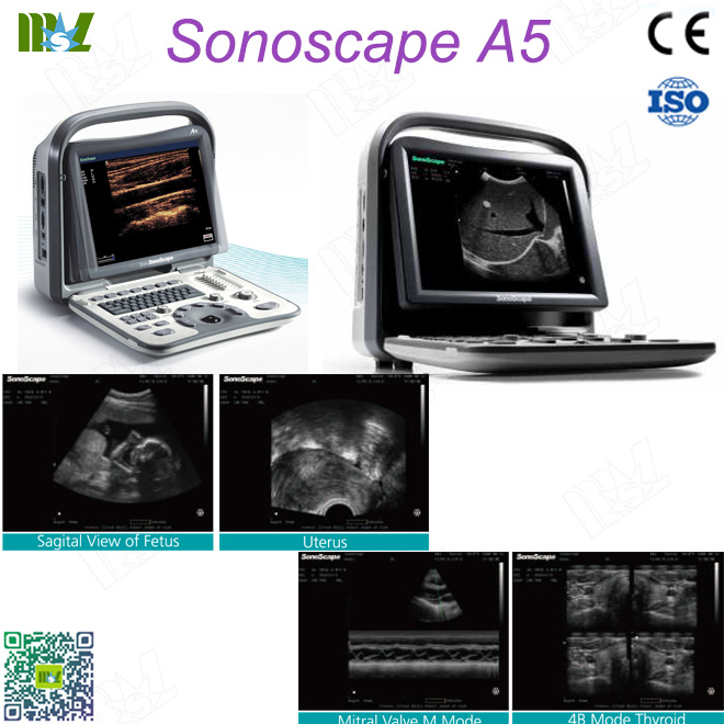 sonoscape a5 price