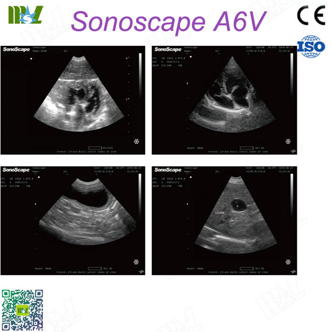 ultrasonido en fisioterapia