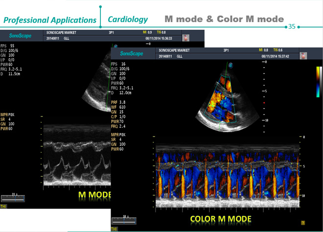 ultrasonido obstetrico pdf