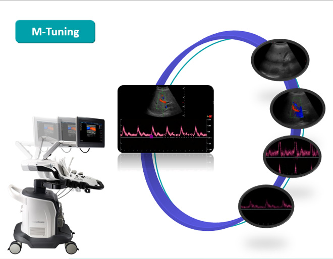 ultrasonido abdominal