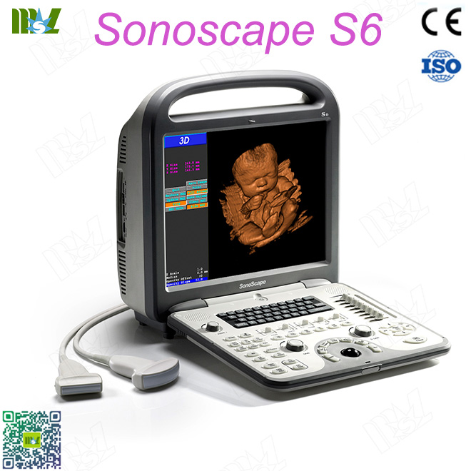 ultrasound