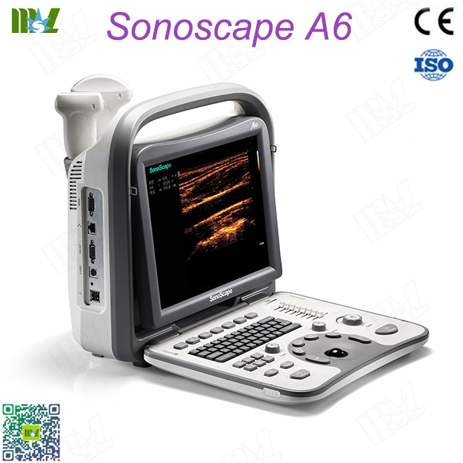 SonoScape A6
