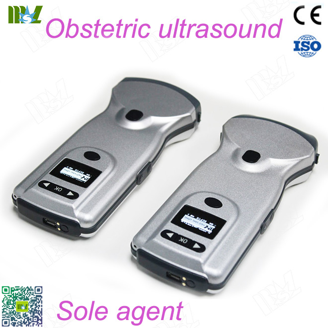 Doppler ultrasound scan
