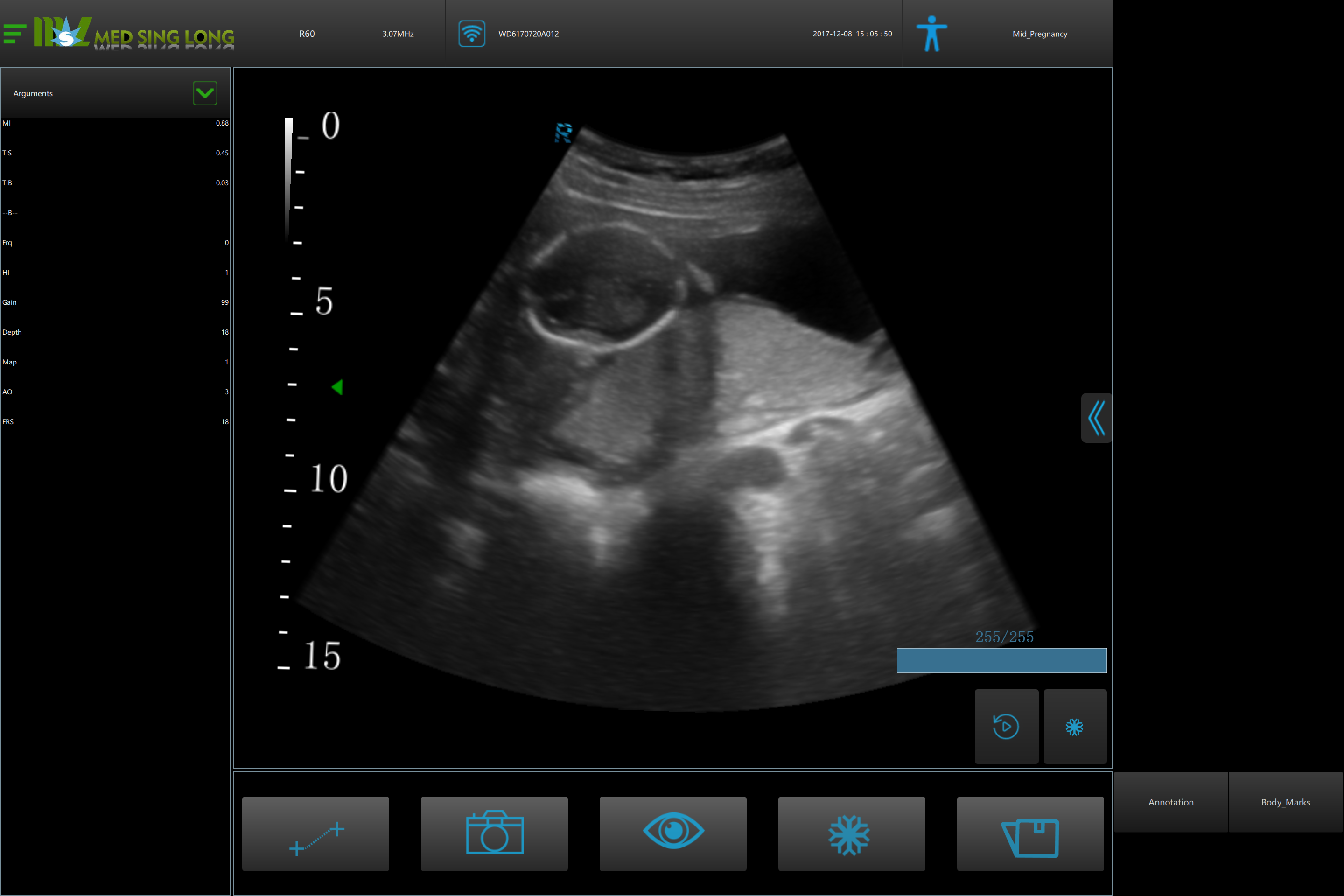medical ultrasound